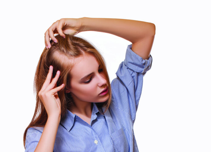 Woman,Serious,Hair,Loss,Problem,For,Health,Care,Hair,Care.
